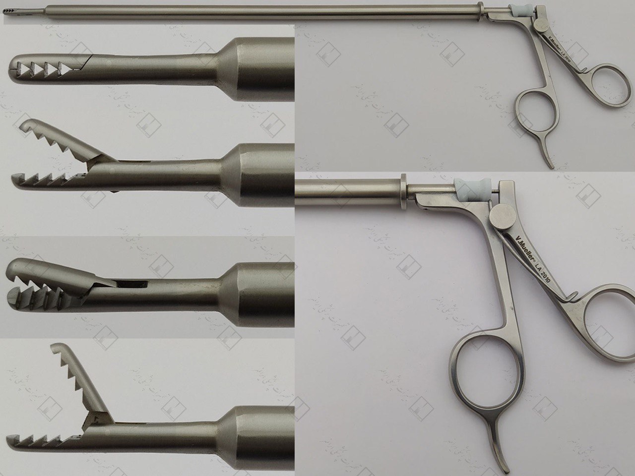 گرسپر لاپاراسکوپی